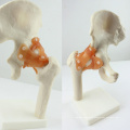 JOINT06 (12353) Medical Anatomy Natural Size Hip Joint Models
